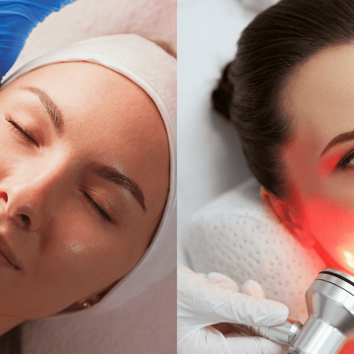 Red Light Therapy: Should You Keep Your Eyes Open or Closed