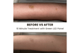 Before and after using Lumara Illuminate Green Professional Green Light Therapy Panel